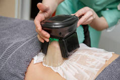 美容治疗师应用冷冻聚合治疗。整容柜中的非手术减肥和身体雕塑