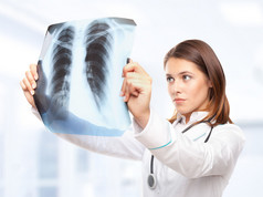 年轻的女医生看着肺部的 x 光照片