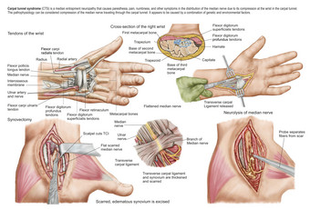 人体手部组织器官图解