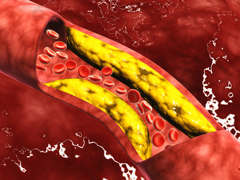 血管里不<strong>健康</strong>的红细胞示例图