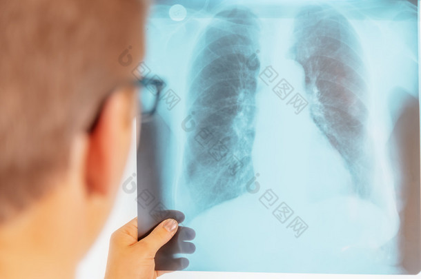医生看着肺部的 x 射线图像