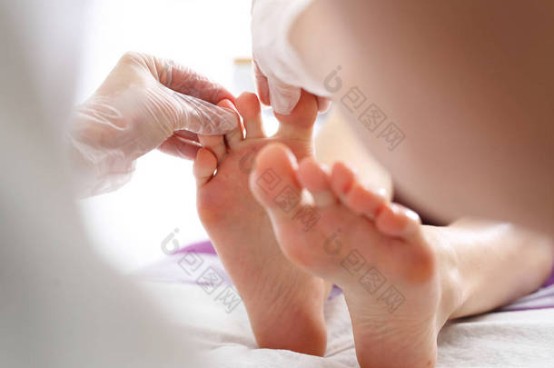 脚趾和指甲真菌。女人在皮肤科医生.