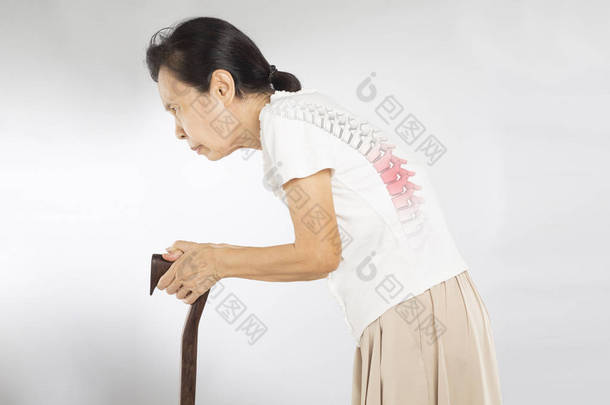 老亚洲 妇女 站在 感觉 脊柱 骨头 疼痛