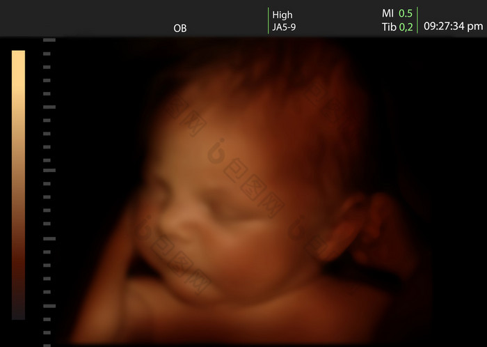 刚出生的婴儿像三维超声的婴儿在母亲的子宫