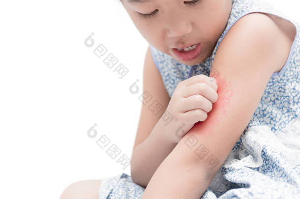 亚洲女孩抓痒用手她的胳膊因为 mosquit