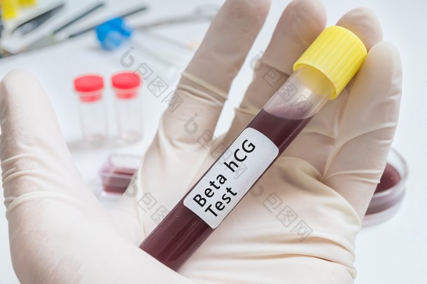 血液为 Beta hcg 测试管在手动测试.