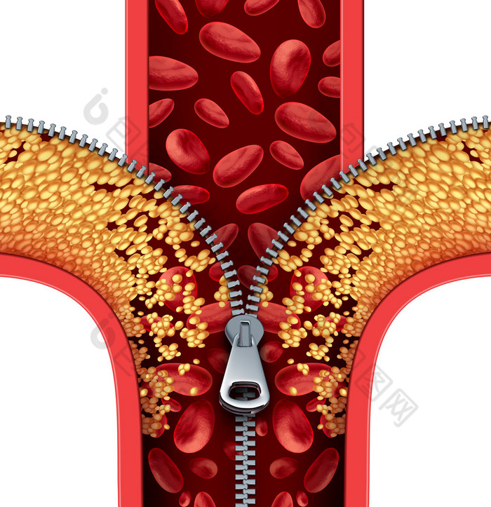 动脉粥样硬化疗法符号