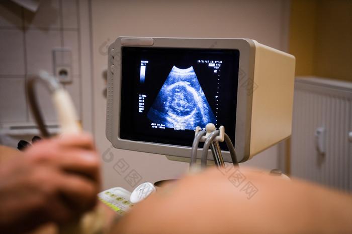 周龄胎儿的超声图像