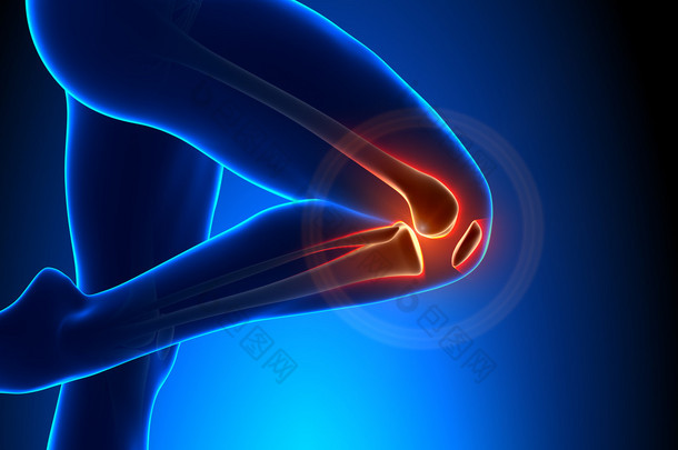 膝关节疼痛高级视图