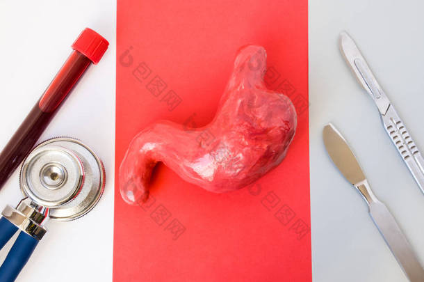 胃外科或手术的胃概念设计照片。图的腹部位于红色背景, 两侧是血管, 听诊器和两个外科手术刀在白色和灰色
