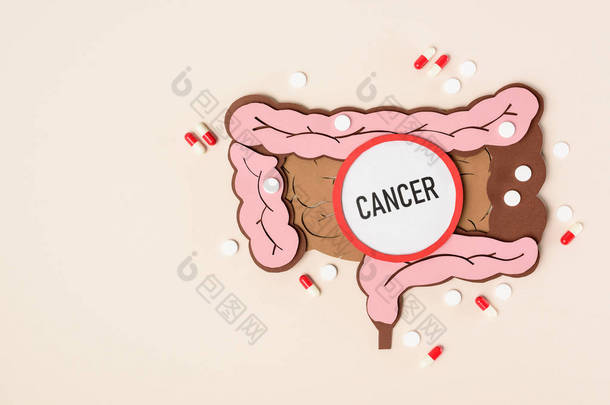 人大肠, <strong>各种</strong>药丸和刻字癌症在米色的顶部视图