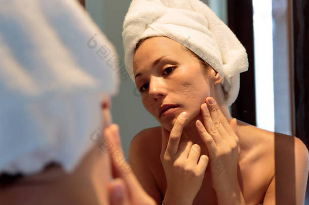 年轻女子在镜子上看着她的粉刺伤疤