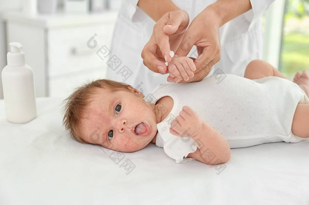皮肤过敏的可爱婴儿在医院接受治疗
