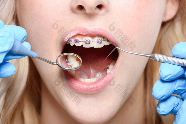 牙医使用的镜子和牙周探针