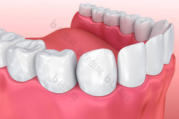 口腔口香糖和牙齿。医学上精确的牙3d 例证 