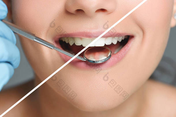 牙医的部分看法与牙科镜子检查女人牙齿, 牙齿美白概念