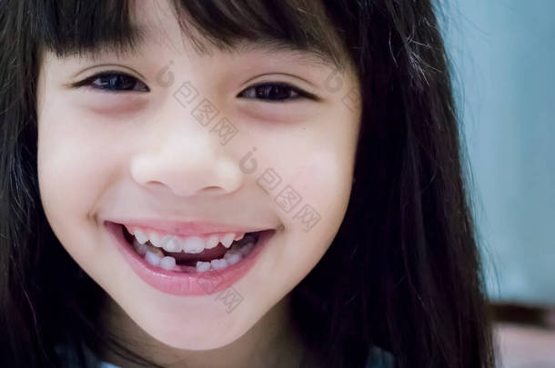 可爱的小女孩露出她破碎的乳牙