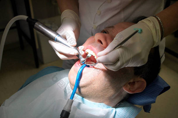 牙科牙齿抛光。牙齿清洁, 牙科卫生。牙科医生在他的牙医诊所和办公室用工具镜、软牙刷和口吸管抛光病人牙齿.