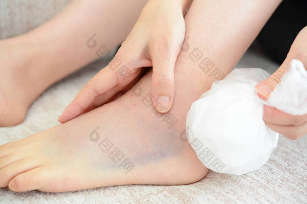 妇女结冰扭伤脚踝与冰包