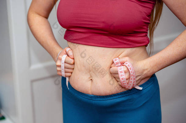 女人捏肚皮脂肪的特写。年轻的苗条女人在蓝色短裤捏她的腹部。饮食和减肥概念. 