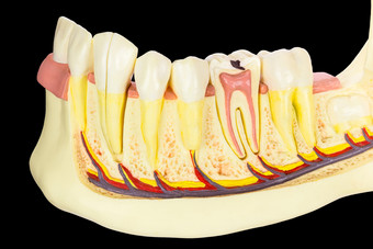 人类下巴模型与牙齿孤立的黑色的背景