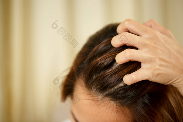 女人有问题与头发和头皮她有头皮屑从过敏反应洗发水和头发护发素