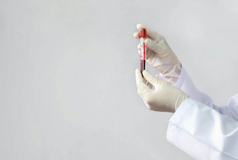 关闭女医生的手白色外套和医疗手套持有测试管真空采<strong>血</strong>管与红色的<strong>血</strong>为测试<strong>血</strong>液学实验室医院医疗和科学概念