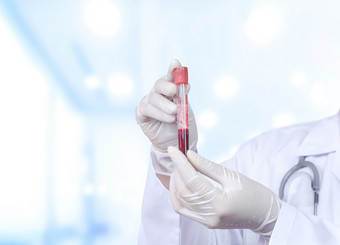 关闭医生的手医疗手套持有测试管真空采血管与红色的血为测试血液学实验室<strong>医院</strong>