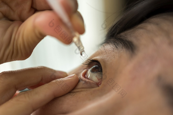 亚洲女人使用眼睛下降人工眼泪滴的眼睛为炎症干燥问题治疗眼球为眼睛健康女人使用眼睛下降人工眼泪的眼睛