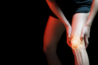 医疗概念女人痛苦与膝盖痛苦的骨架x射线
