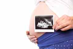 怀孕了女人显示超声波扫描