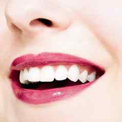 完美的微笑健康的白色自然牙齿快乐微笑牙科美