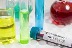 淋病血测试管积极的样本实验室诊断化学元素