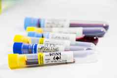 猪流感诊断实验室测试血测试管样品文本信