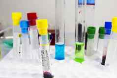 葡萄球菌细菌血测试管样品实验室化学液体元素收拾残局