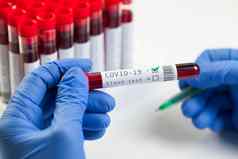 医生实验室科学家标签测试管冠状病毒