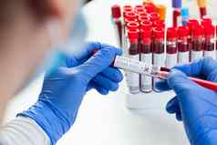 医生实验室科学家标签测试管冠状病毒帕特