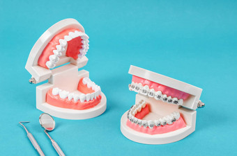 比较牙模型牙模型金属线牙科撑