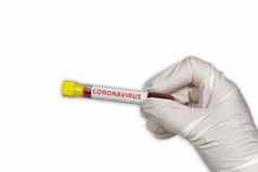 科维德世界爆发概念冠状病毒标签真空采血管