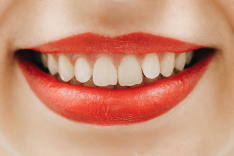 完美的微笑漂白牙科护理<strong>美白</strong>牙齿口腔学美护理女人微笑伟大的牙齿快乐的女微笑新鲜的清晰的皮肤