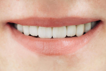 美丽的女牙齿宏锆特写镜头<strong>微笑照片</strong>锆人工牙齿氧化锆桥瓷