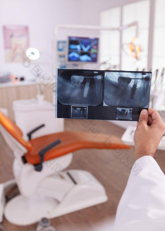 专家牙齿矫正医师医生持有牙齿手术射线照相法