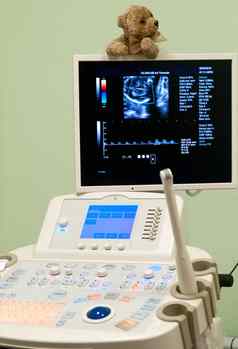 医疗设备超声波扫描诊断怀孕