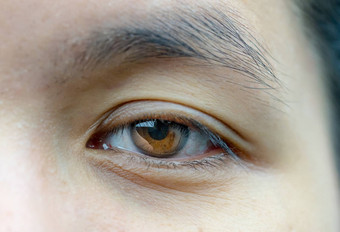 宏拍摄亚洲中间岁的女人棕色（的）眼睛皱纹眼睛显示静脉眼睛眼睑问题手术电梯