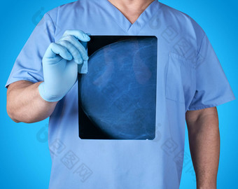 医生蓝色的统一的乳胶手套持有x射线