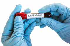 测试管疫苗冠状病毒SARS-cov-