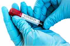 冠状病毒血样本测试管生化