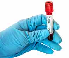 冠状病毒法律顾问血样本测试管生化