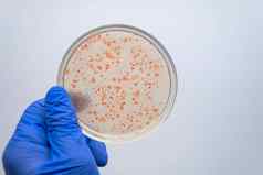 科学家们研究微生物群肠