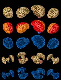 集孤立的大脑呈现分裂x射线检查风格图像彩色的功能区情报概念数字mpx医疗插图